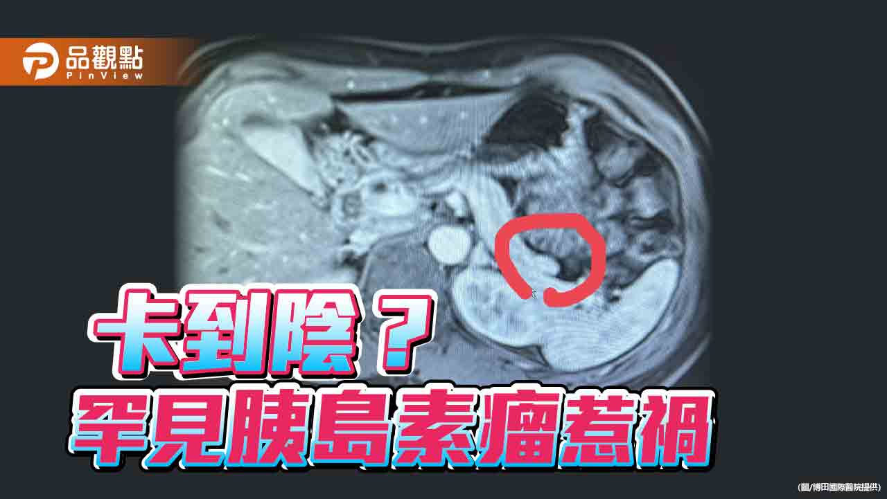 卡陰？行為異常？病患切除罕見胰島素瘤恢復正常