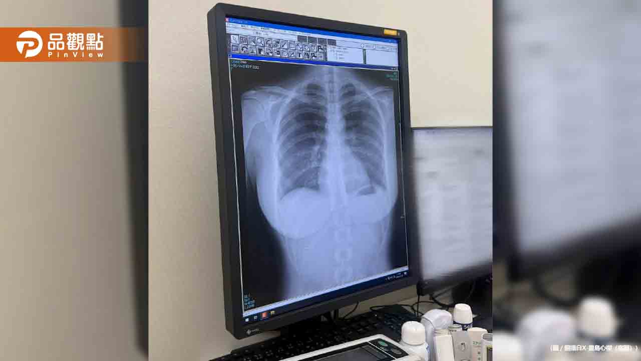 日本寫真偶像X光照瘋傳！千萬人搶看「1重點」