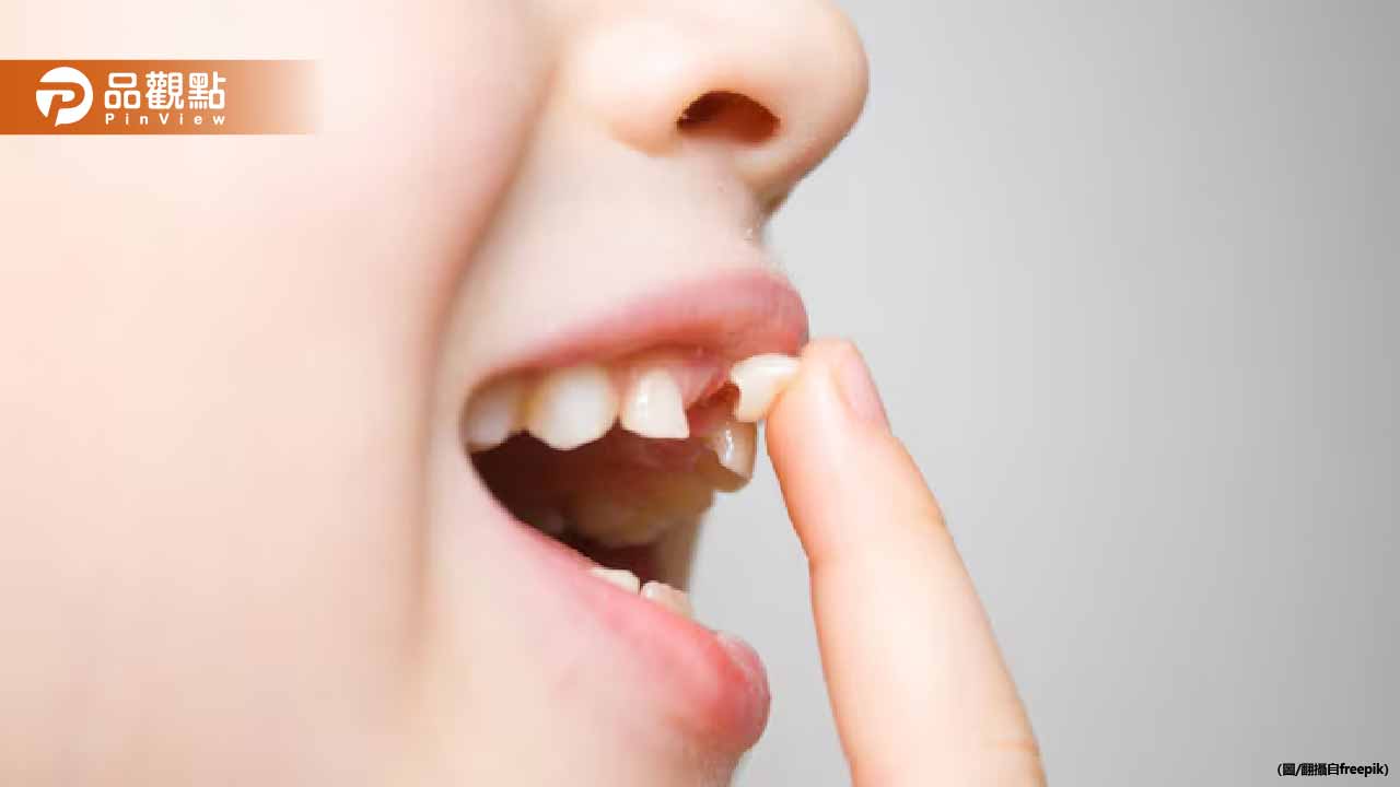 揮羽球拍擊傷女同學害門牙斷裂！基隆某國中母子賠7.5萬