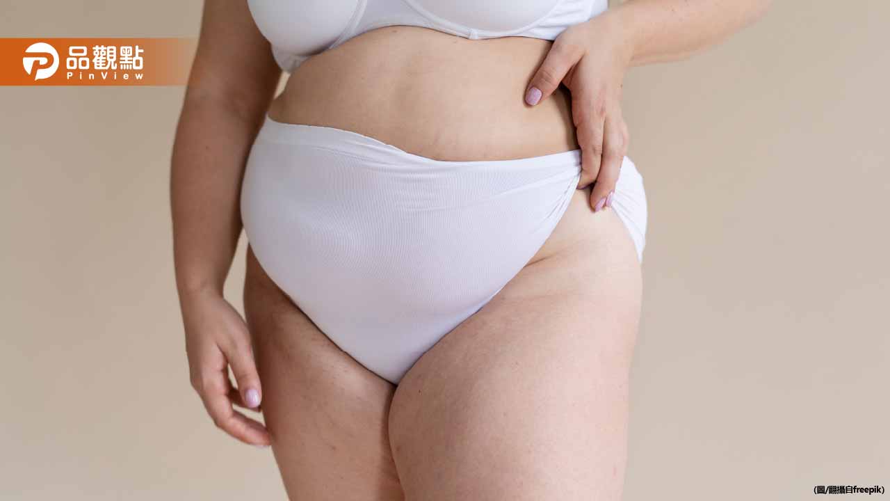 比內臟脂肪更危險！大腿長「雪花肌」恐是糖尿病前兆