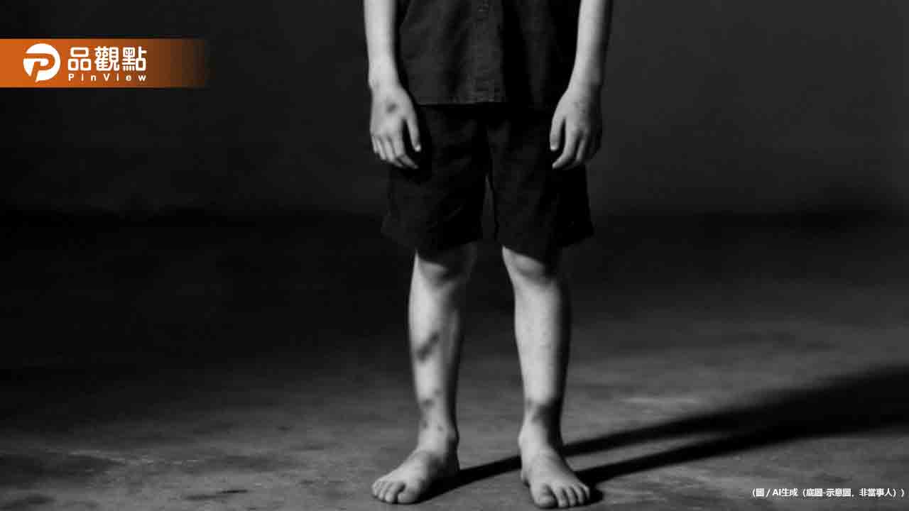 男童全身瘀青送急診!白血球飆百倍、併發腦出血不治